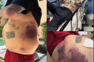 ‘Pawn Stars’ Corey Harrison issues plea to fans after near-death accident