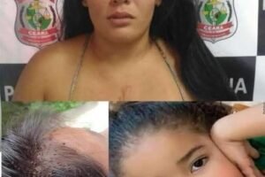 3-year-old girl after lice and mother warns… See More
