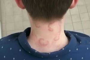 “My 8-Year-Old Has Been Dealing With This for Two Months and It’s Only Getting Worse” — What Parents Should Know