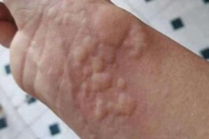 These are the consequences of sleeping with…