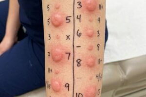 🚨 “I Noticed a Small Bump… Then I Realized How Common This Actually Is”