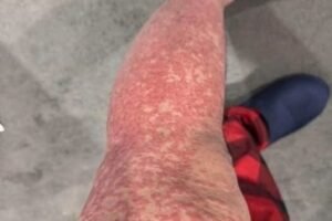 These are the consequences of sleeping with, See it!