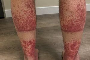 The Shocking Consequences of Sleeping With the…See more