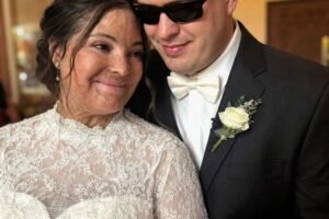 I Married a Blind Man So He’d Never See My Scars – On Our Wedding Night, He Said, ‘You Need to Know the Truth I’ve Been Hiding for 20 Years’