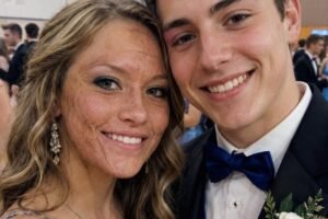 A Boy Asked Me to Dance at Prom Because No One Else Would Due to My Scars – The Next Day, His Parents and Officers Showed up at My Door