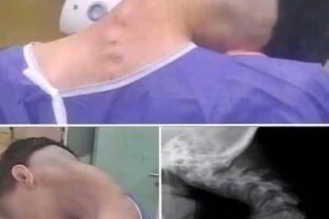 7. Young Man Hospitalized Because He Dropped His Ca…See More