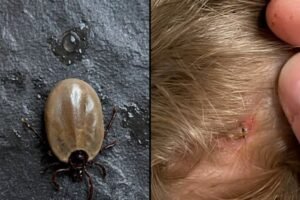 How to stay calm when you find unwanted “guests” in your child’s hair.