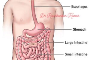 Cᴀɴᴄᴇʀ in the stomach develops silently. These are the first signs! You should be attentive! See below⬇️