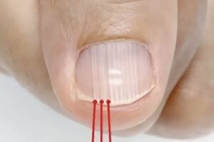 If you have these lines on your nails after 40, it is a clear sign that…