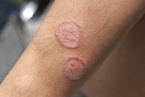 When Skin Symptoms May Signal More Than a Simple Irritation