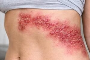 Why a Dirty Bed Can Affe
