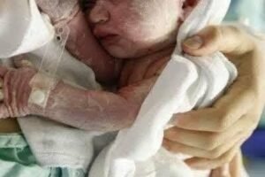 Baby born with an DIU peg… See more