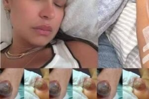 These are the consequences of sleeping with…