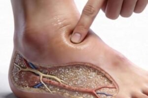 These are the consequences of wearing used…