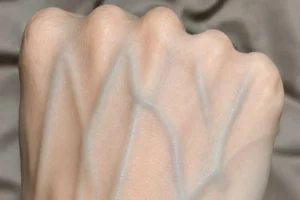 Visible Veins Explained: Normal Causes, Health Risks, and When to Worry!!