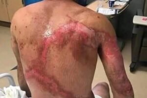 These are the consequences of sleeping with your a