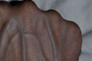 Visible Hand Veins Explained: Why They Appear, From Low Body Fat, Genetics, Exercise, Heat, and Hydration Changes, and When They Are Normal or Rarely a Sign of Medical Concern, Offering Reassurance That Prominent Veins Are Usually Harmless Physical Traits While Highlighting Simple Lifestyle Factors That Influence Their Appearance Over Time Naturally and safely understood today