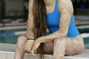 These are the consequences of sleeping with the…