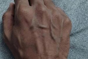 Visible Veins? Here’s What They Could Be Telling You About Your Health