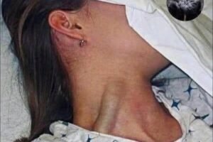 SENSATIONAL TRAGEDY Young Woman Loss Sparks Massive Global Conversation On Hidden Health Dangers