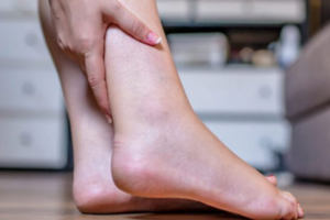 Persistent Leg Swelling and Skin Changes: Signs You Shouldn’t Ignore