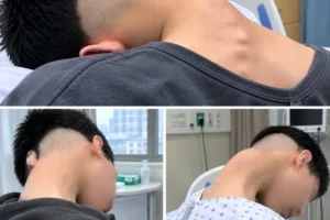 Neck Warning: Young Man in Hospital After His Head Suddenly Dropped