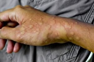 These are the consequences of sleeping with the….